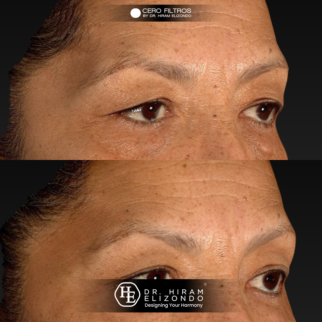 Dr-Hiram-Elizondo-Ceja-0