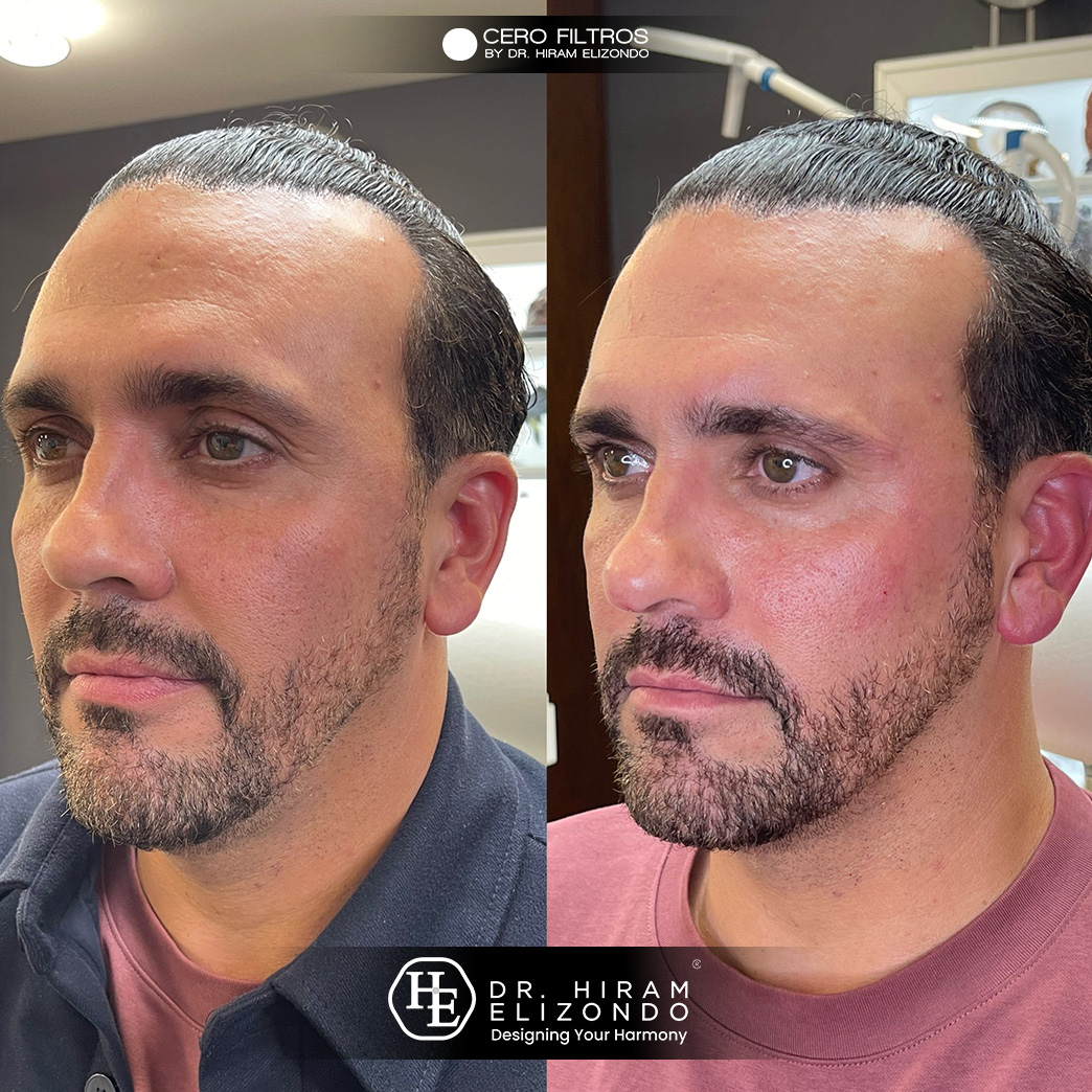 Dr-Hiram-Elizondo-Pomulos20