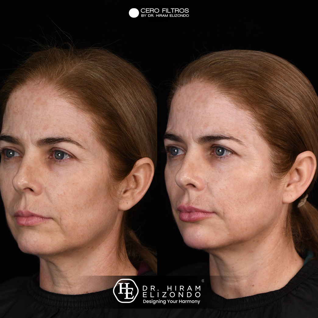 Dr-Hiram-Elizondo-ceja1