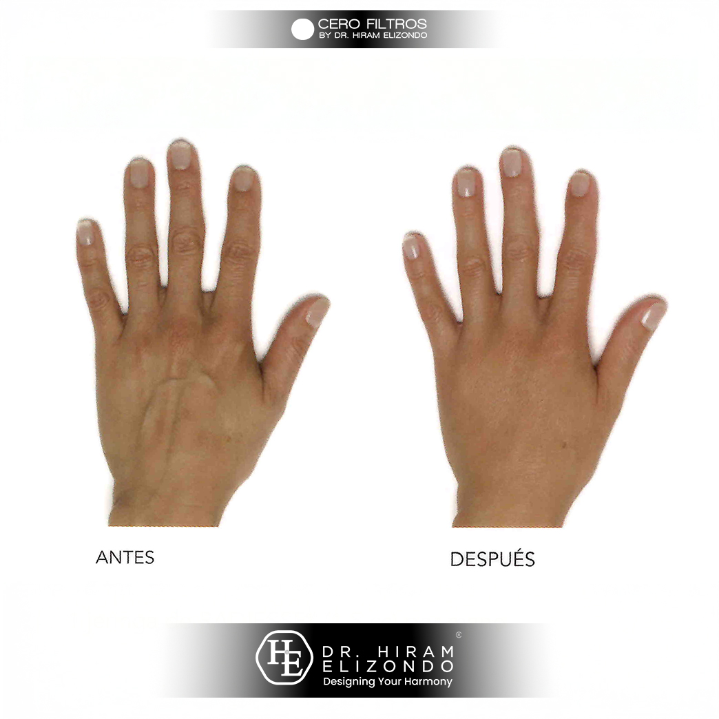 Dr-Hiram-Elizondo-manos-1