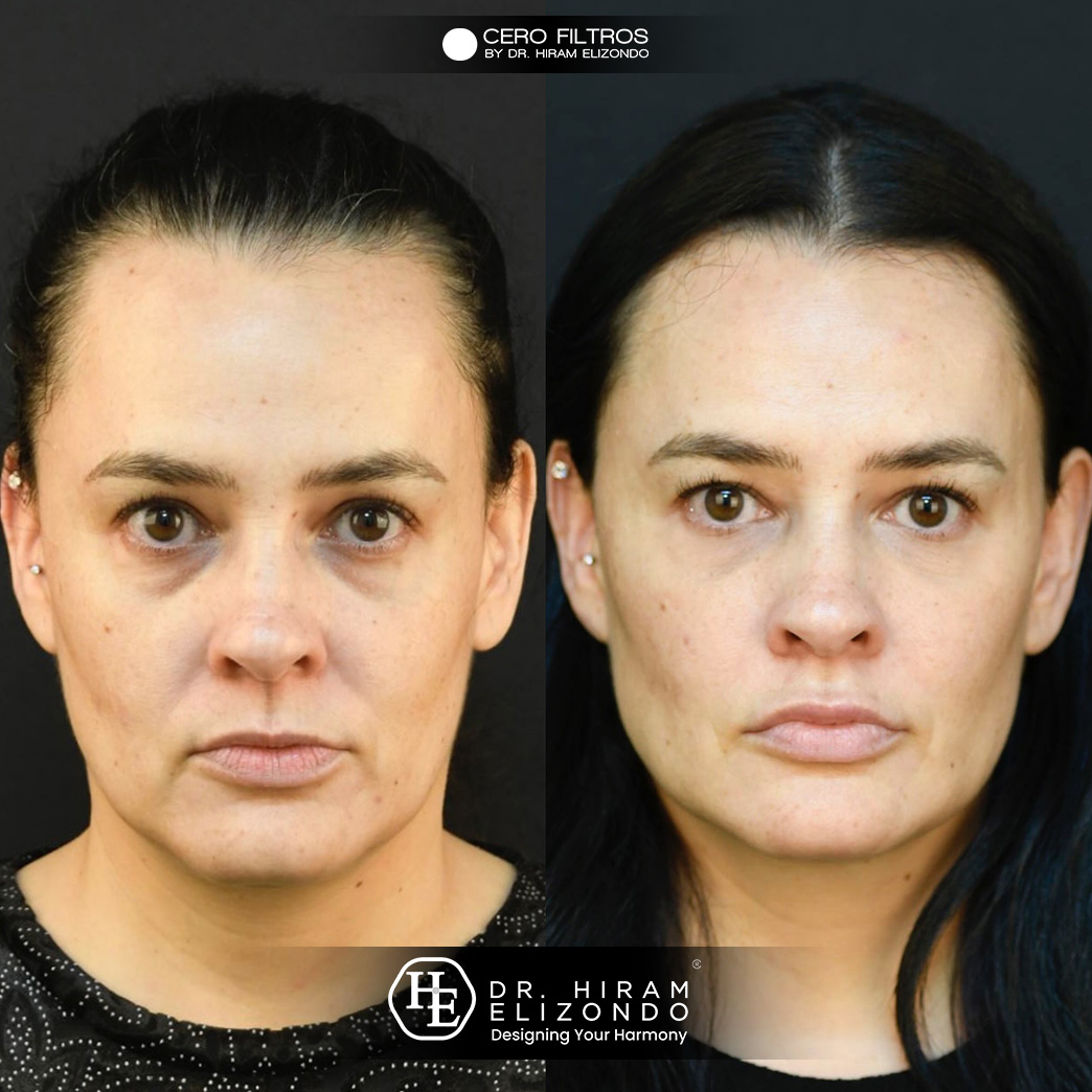 Dr-Hiram-Elizondo-pomulos24